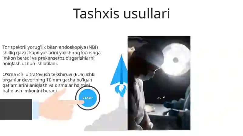 OIT da operativ endoskopiya 3