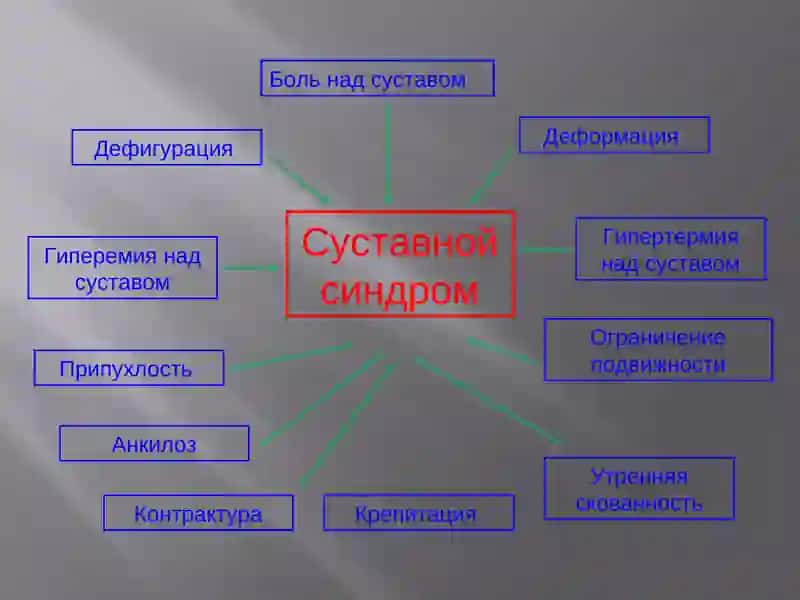 Суставной синдром 3