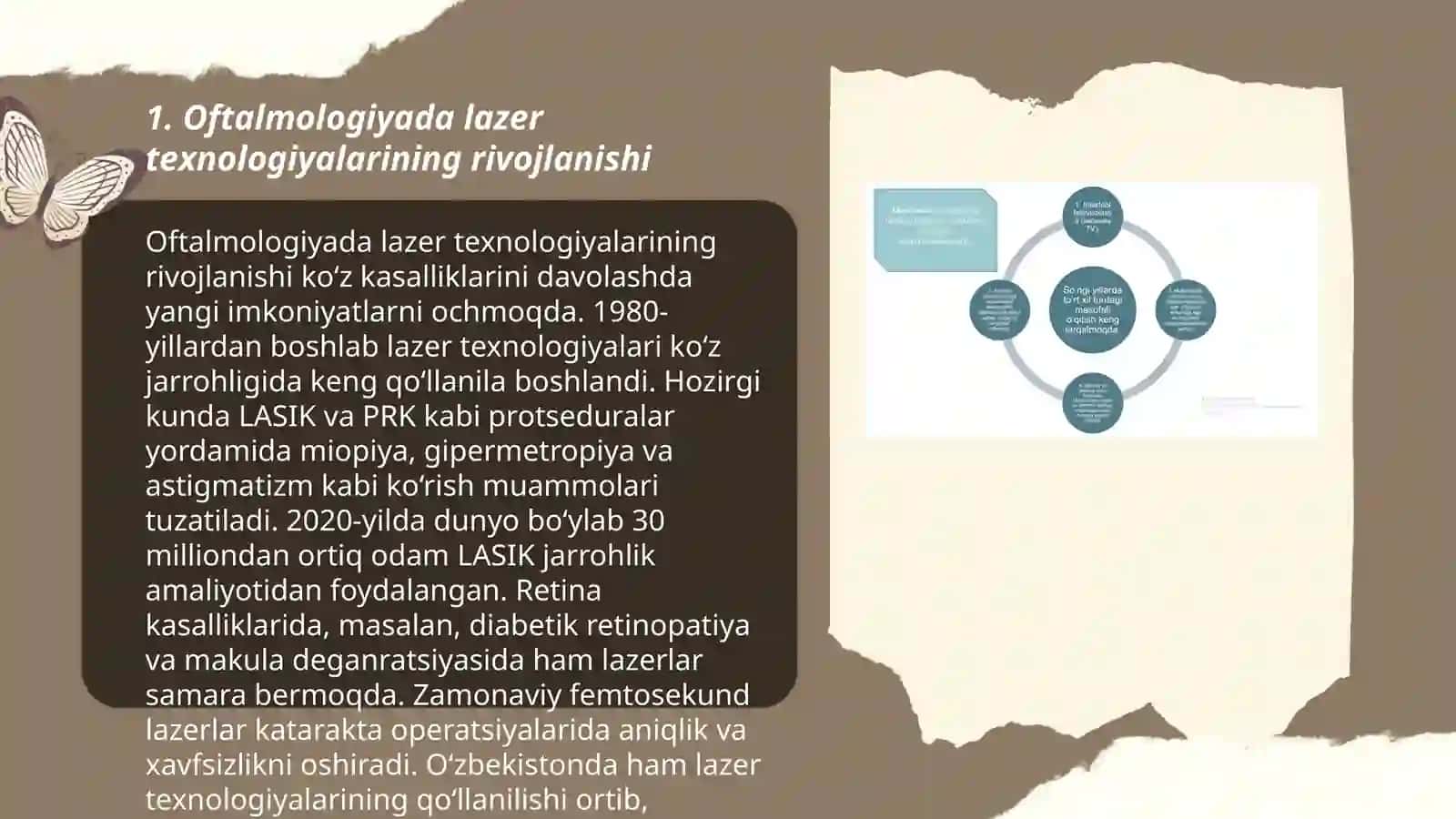 Oftalmologiyada lazer texnologiyalarining rivojlanishi 3