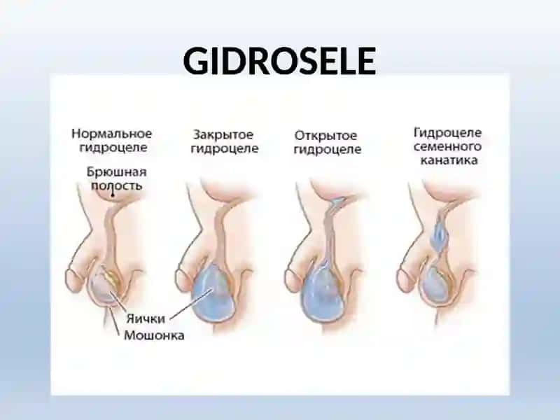 ERKAKLAR TANOSIL A`ZOLARI, AYOLLAR TANOSIL A`ZOLARI 3