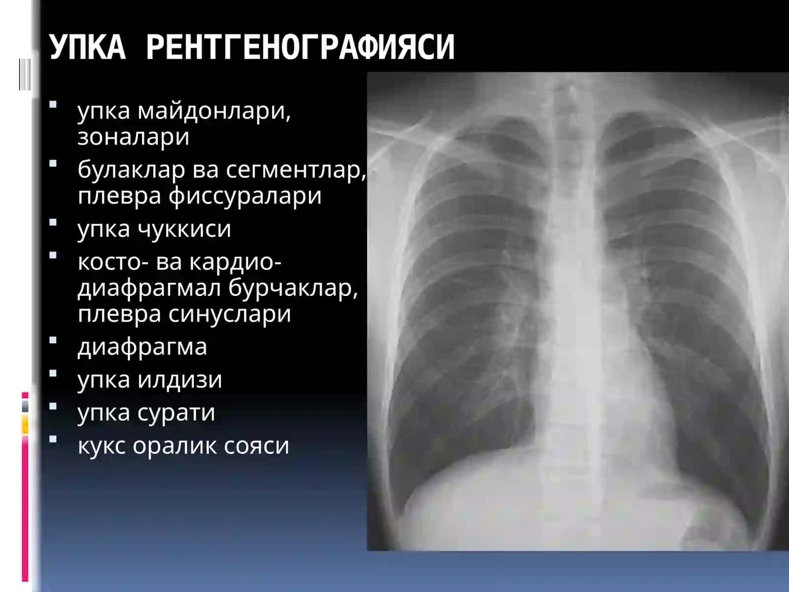 УПКА КАСАЛЛИКЛАРИНИНГ НУР ТАШХИСИ 3