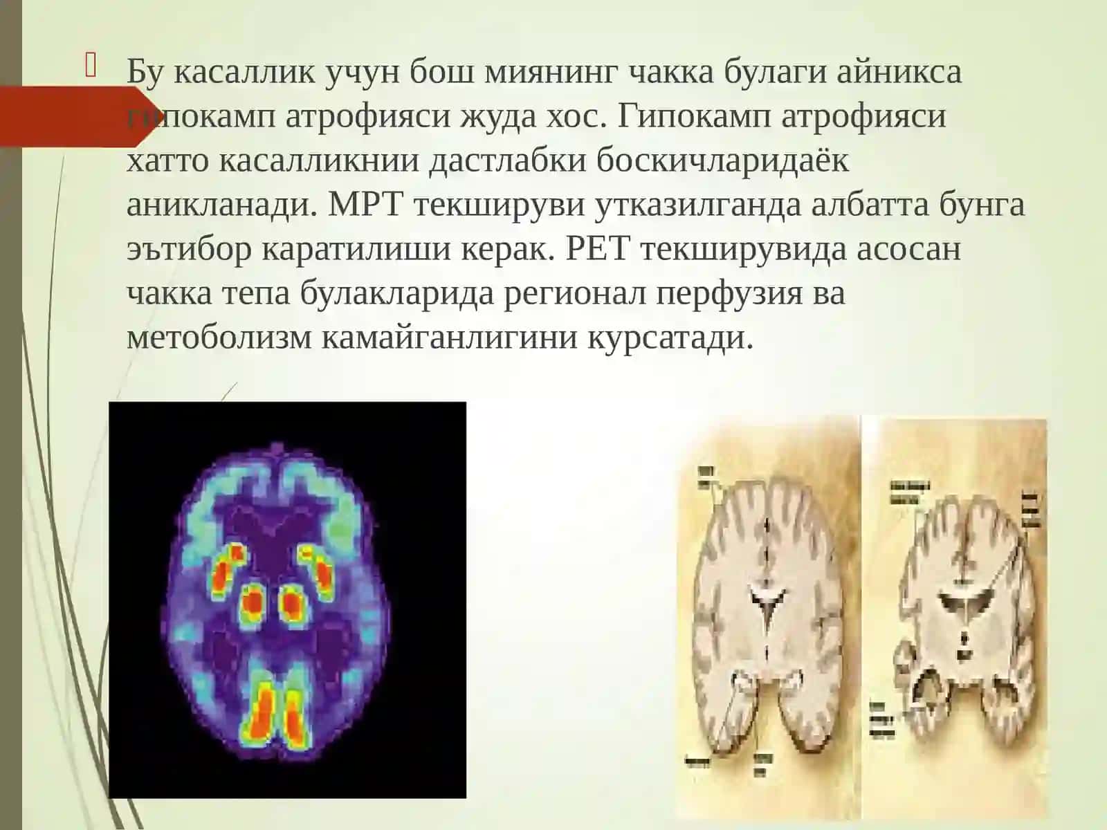 Нейродегенератив касалликлар (Альцгеймер, Паркинсон касалликлари, Гентингтон хореяси. Этиологияси, патогенез, клиника, диагностика, диф.диагностика. Нерв мушак дистрофиялари -Миопатиялар (Дюшен, Эрба Рота,Ландузи-Джерин,Беккер) 3
