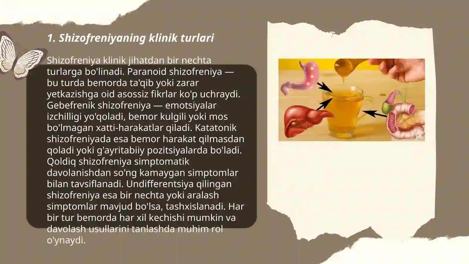Endogen ruxiy kasalliklar:shizofreniya,shizotipik va vasvasali buzilishlar 3