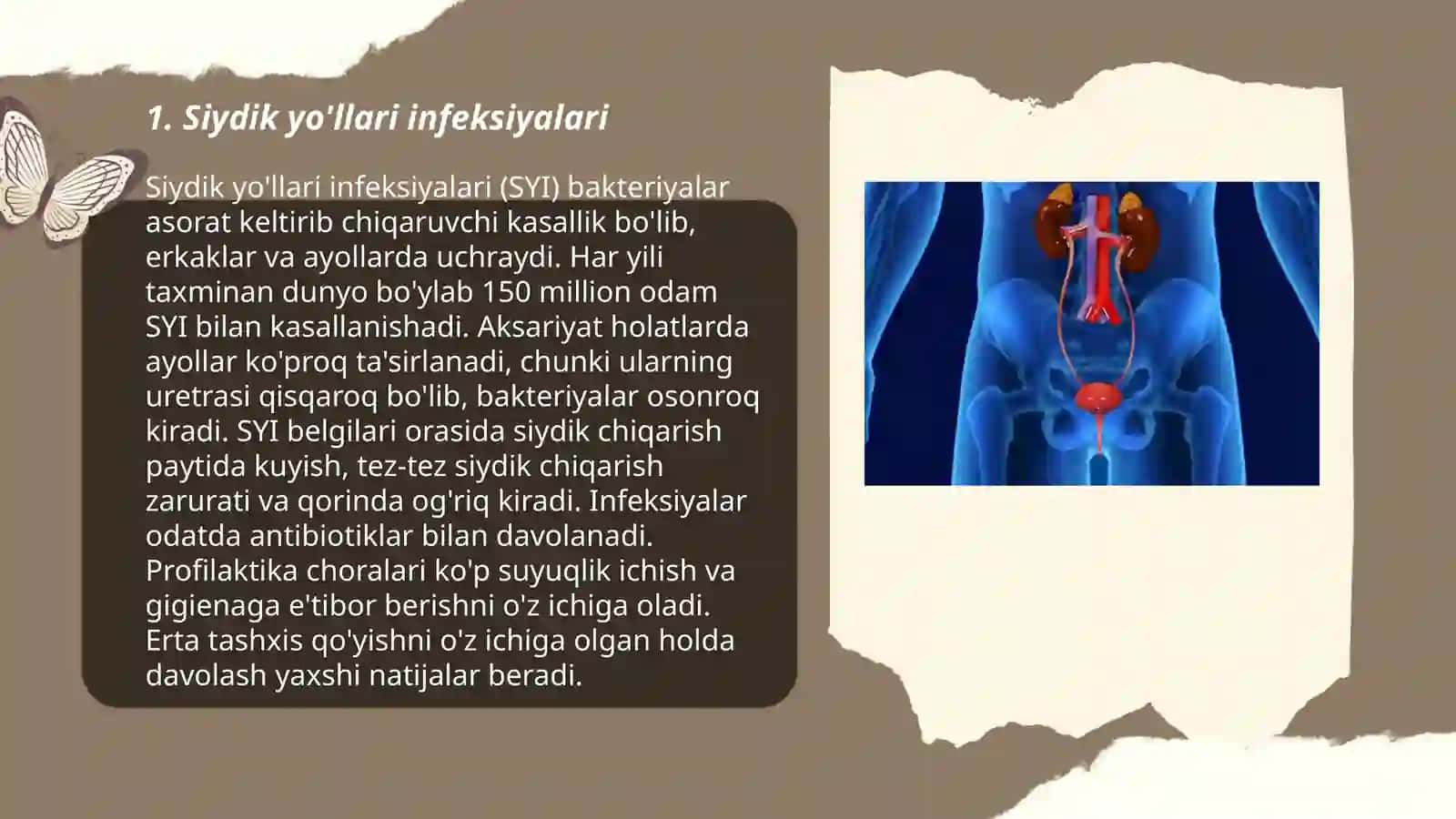 Siydik-tanosil tizimining kasalliklari 3