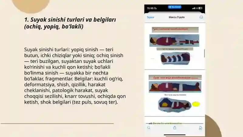 Suyak sinishida birinchi tibbiy yordam 3