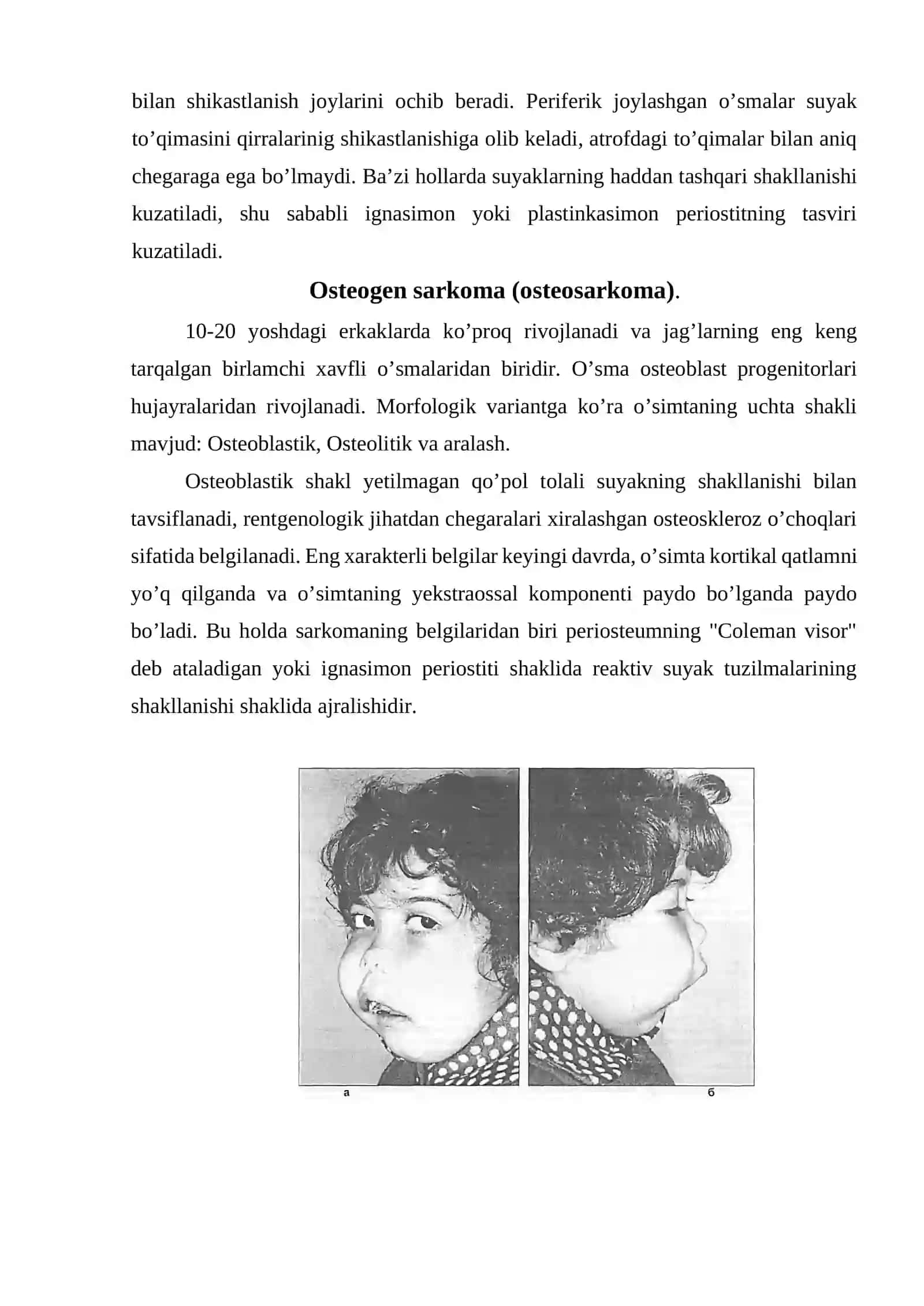 Jag’ning xavfli o’smalari 3