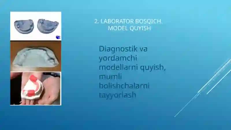 Byugel protezini tayyorlashning klinik-laborator bosqichlari 3