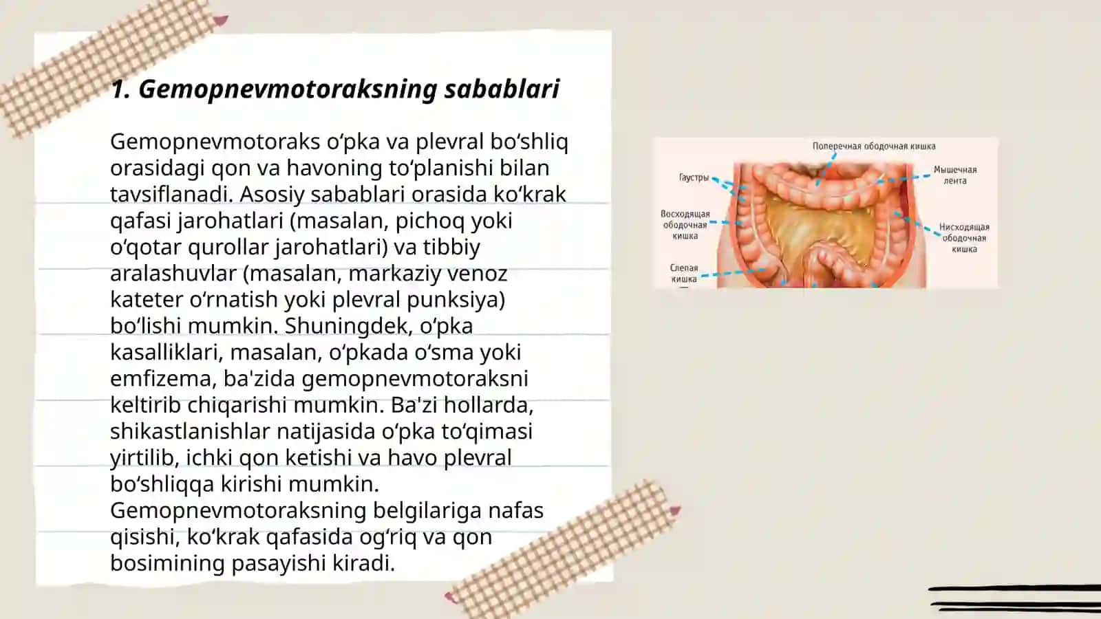 Gemopnevmotoraks,yiringli plevrit klinik manzarasi, kechishi tekshirish usullari. Gemoperitenium, peritanit haqida tushuncha 3