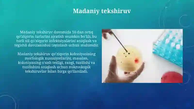 Zambarli kasalliklarning laboratoriya tashhisi 3