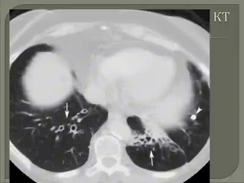 YURAK-QON TOMIRLARI KASALLIKLARIDA KOMPYUTER TOMOGRAFIYANING AXAMIYATI 3
