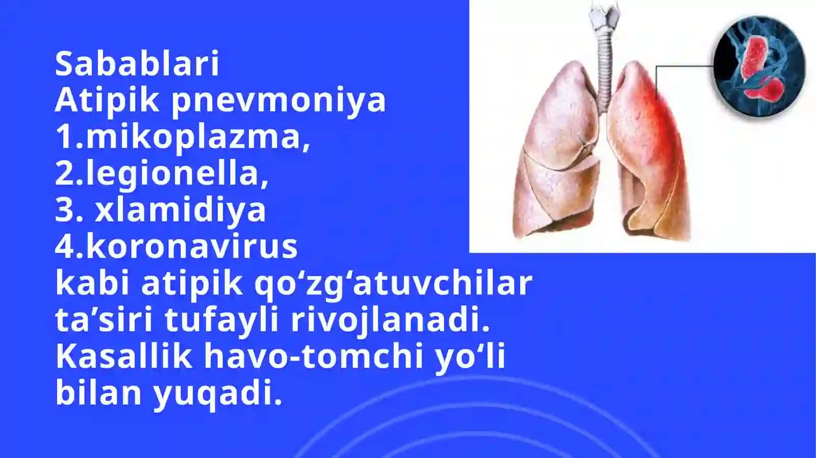 Atipik pnevmoniyalar 3