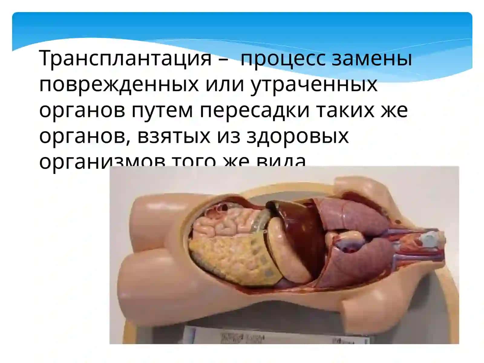 Трансплантация 3