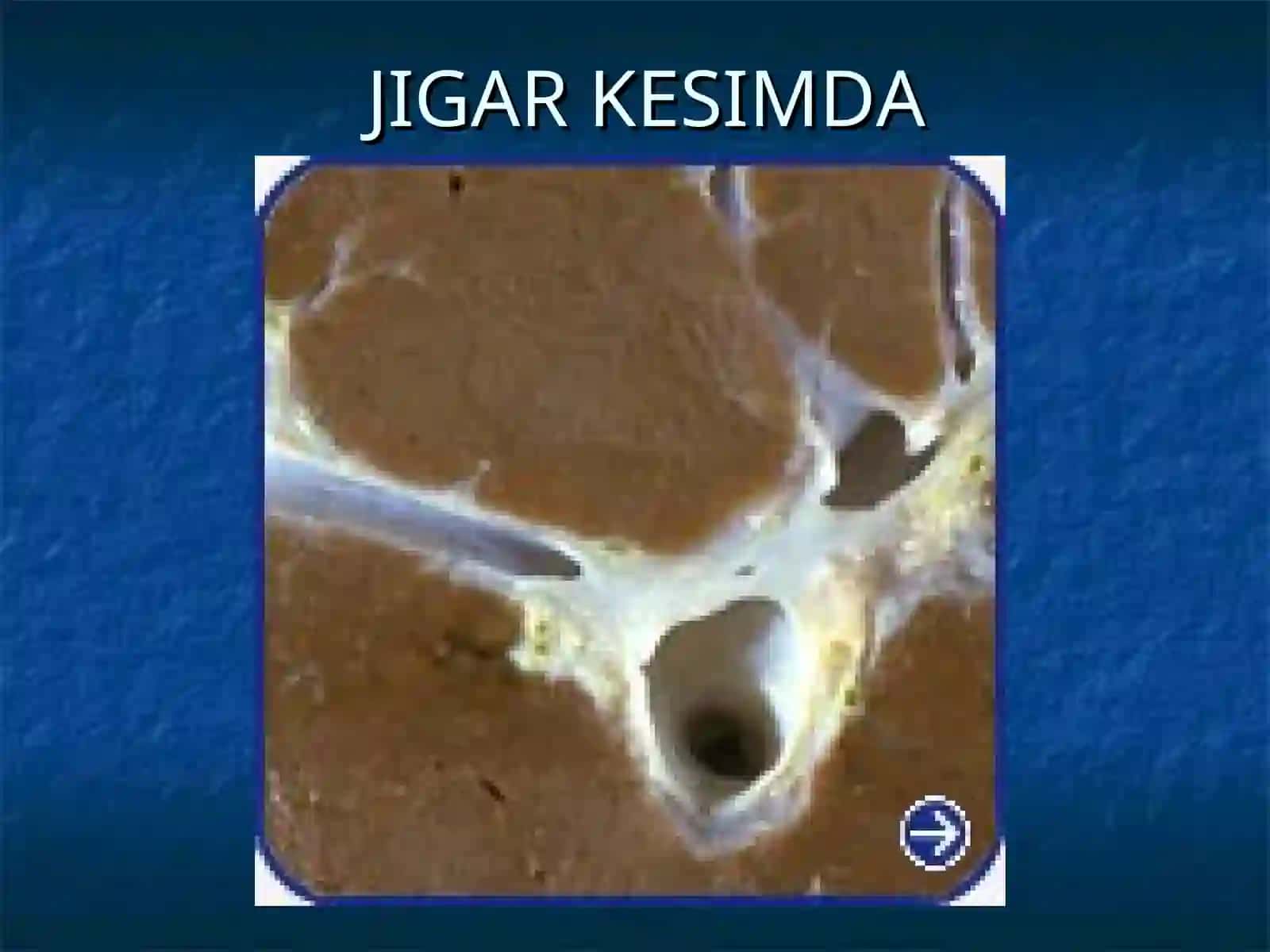 JIGAR SIRROZI 3