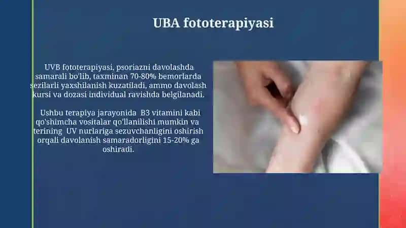 Ósma va boshqa kasalliklar nur terapiyasi 3