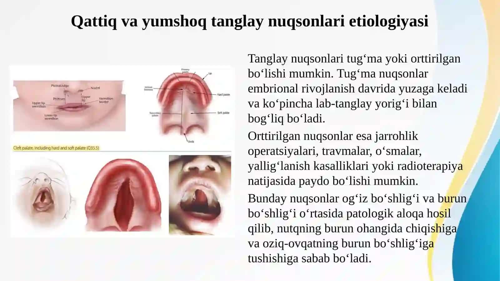 Tish jag tizimi qattiq va yumshoq tanglayning turli nuqsonlarini protezlashda umumiy amaliyot shifokor stomatologining anaanviy va raqamli texnologiyalar usullarini bilishi profilaktik korik asorat turlari birinchi yordam korsatish 3