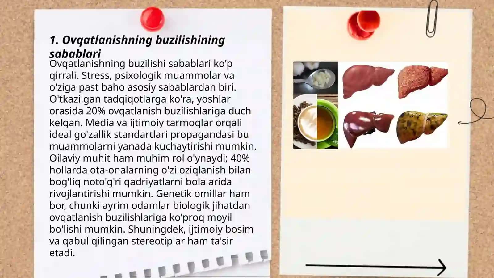 Ovqatlanishning buzilishi-jigar patologiyasining sababi 3