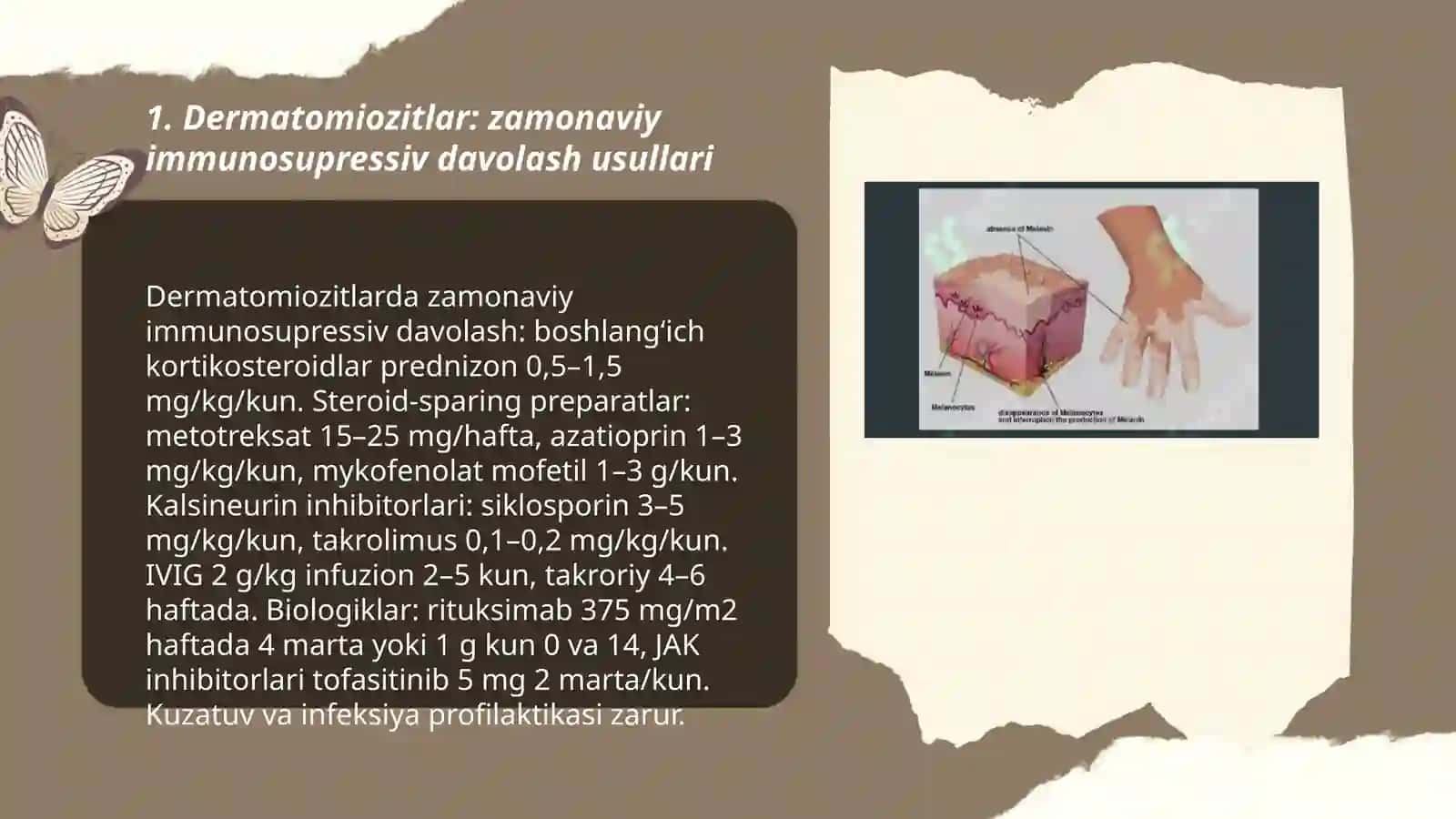 Dermatomiozitlar.Vitiligoning zamonaviy davolash usullari 3