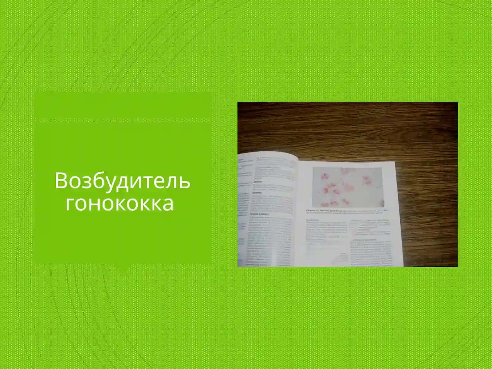 Возбудитель Neisseria gonorrhoeae 3