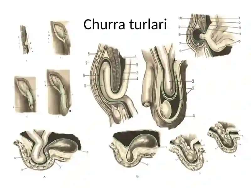 Chov churralari 3