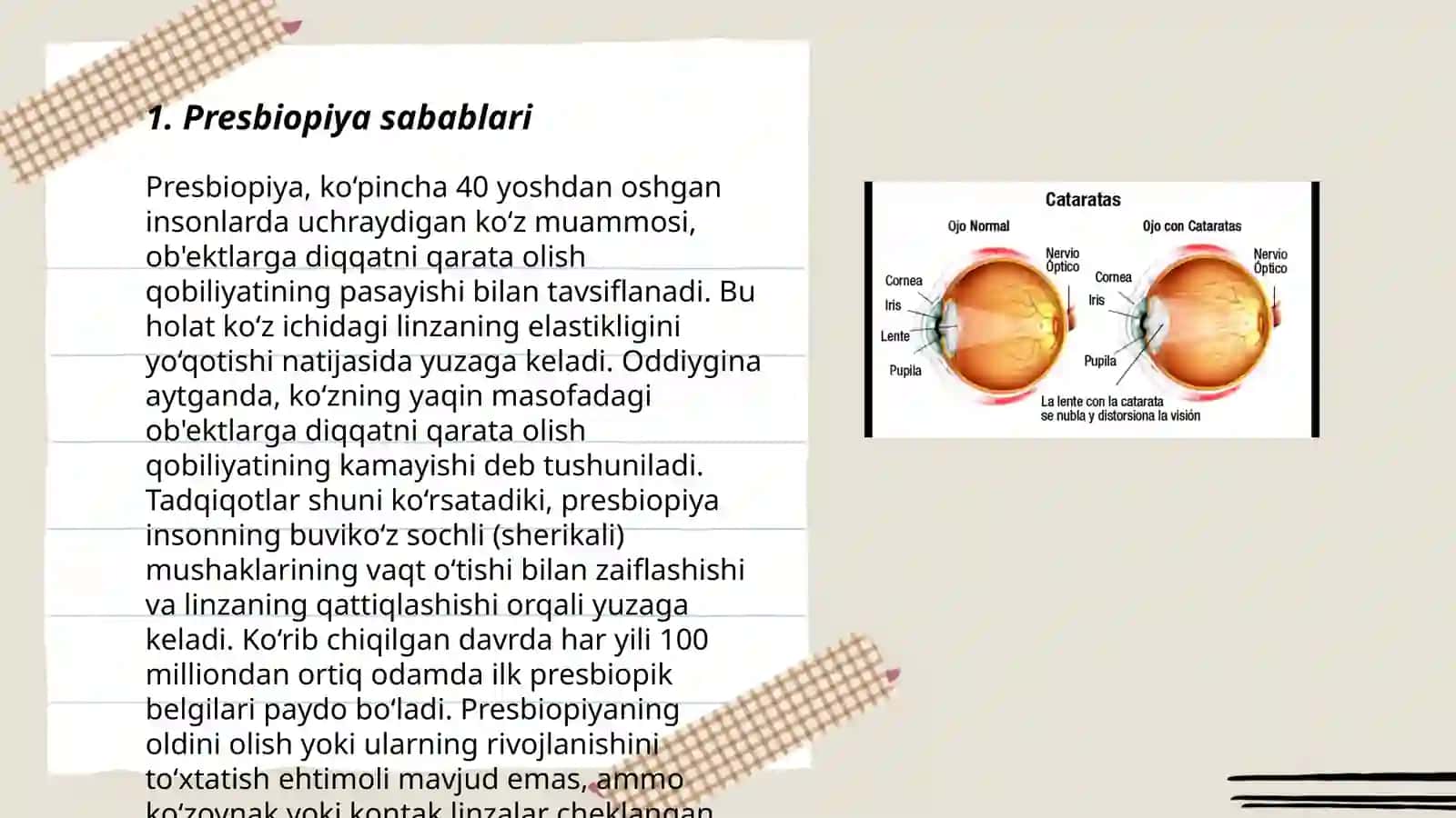 Presbiopiya 3
