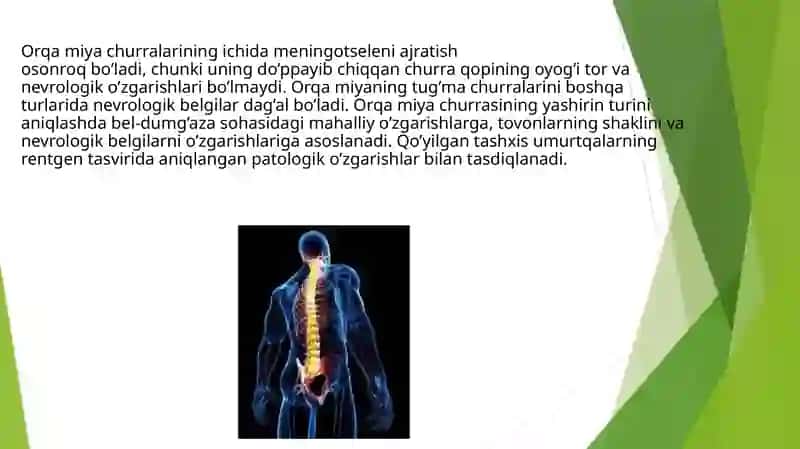 Orqamiyachurralarida operatsiya 3