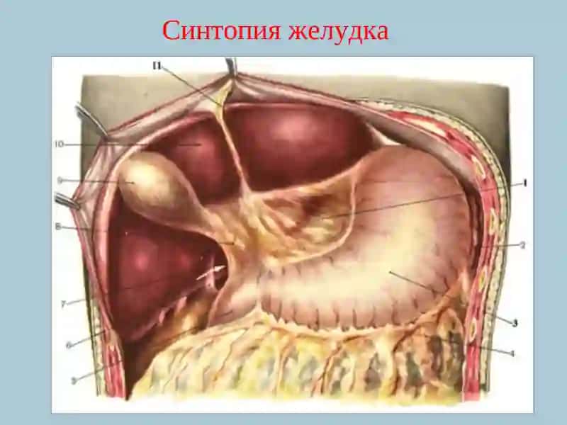 ЯЗВЕННАЯ БОЛЕЗНЬ ЖЕЛУДКА И ДВЕНАДЦАТИПЕРСТНОЙ КИШКИ 3