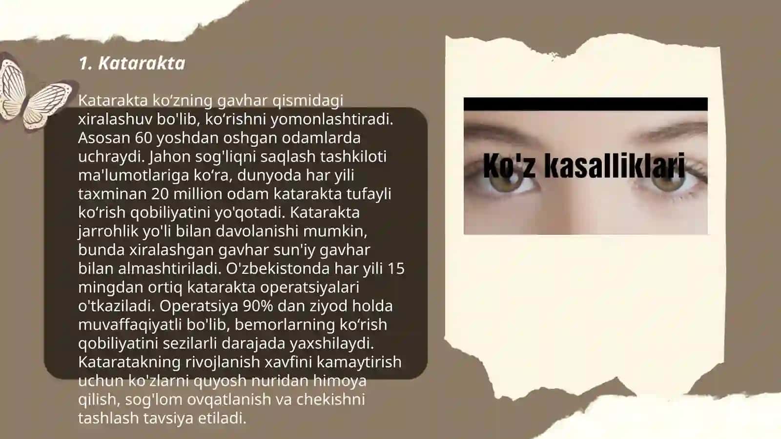 Ko'z kasalliki 3