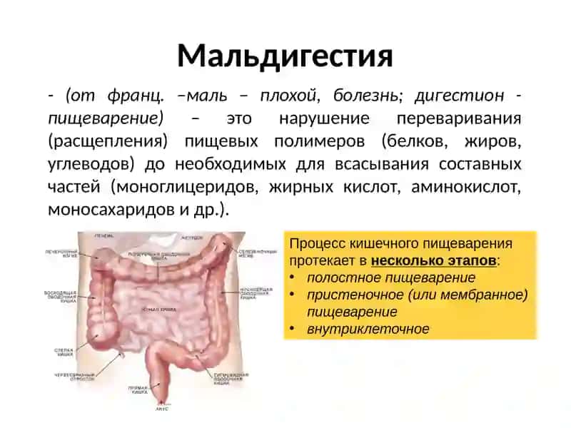 ОСНОВНЫЕ СИНДРОМЫ ПРИ  ЗАБОЛЕВАНИЯХ КИШЕЧНИКА 3