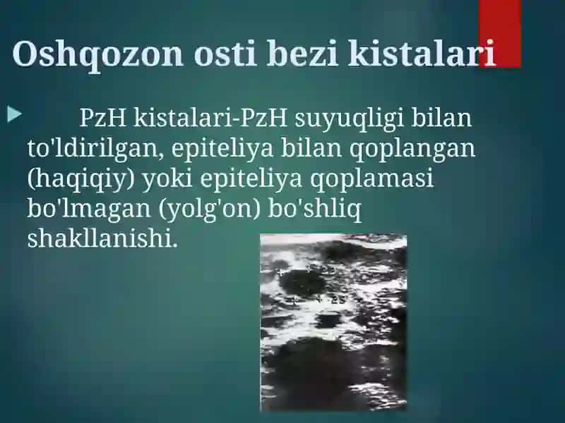 Oshqozon osti bezi kistalari 3