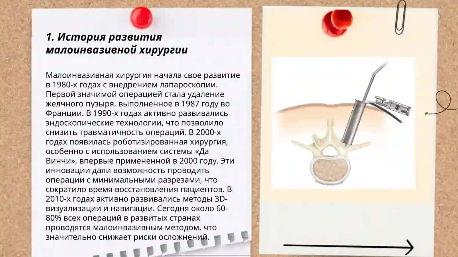 Малоинвазивная хирургия: преимушества и перспективы 3