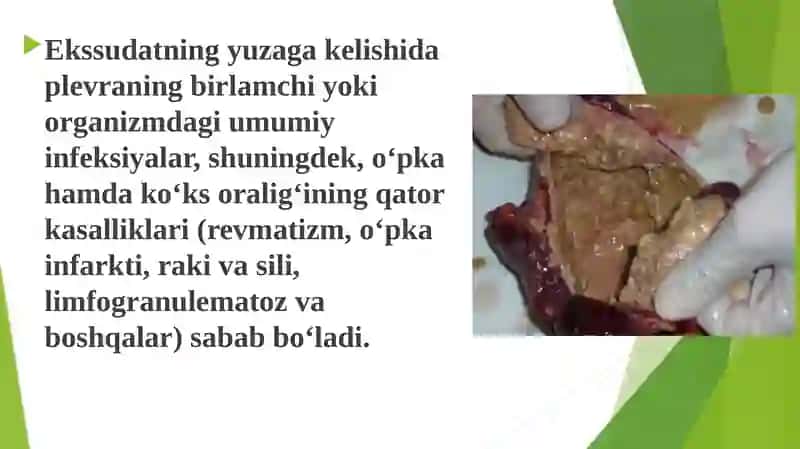 plevra suyuqligini labarator tekshirish 3