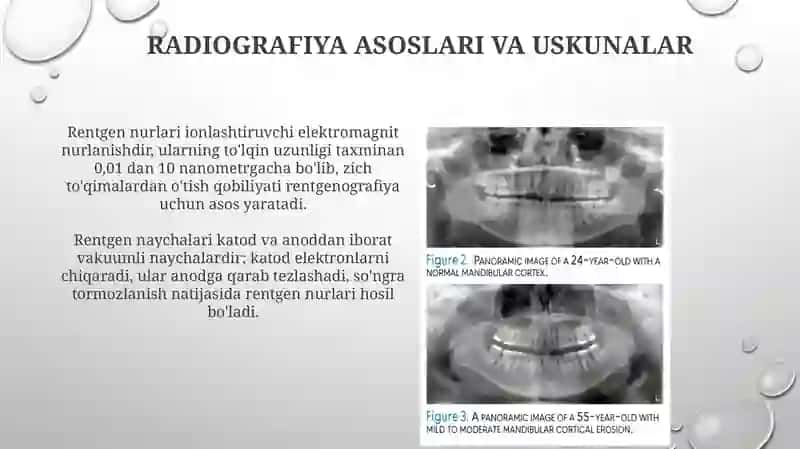 Radiografiya asoslari va texnikasi 3