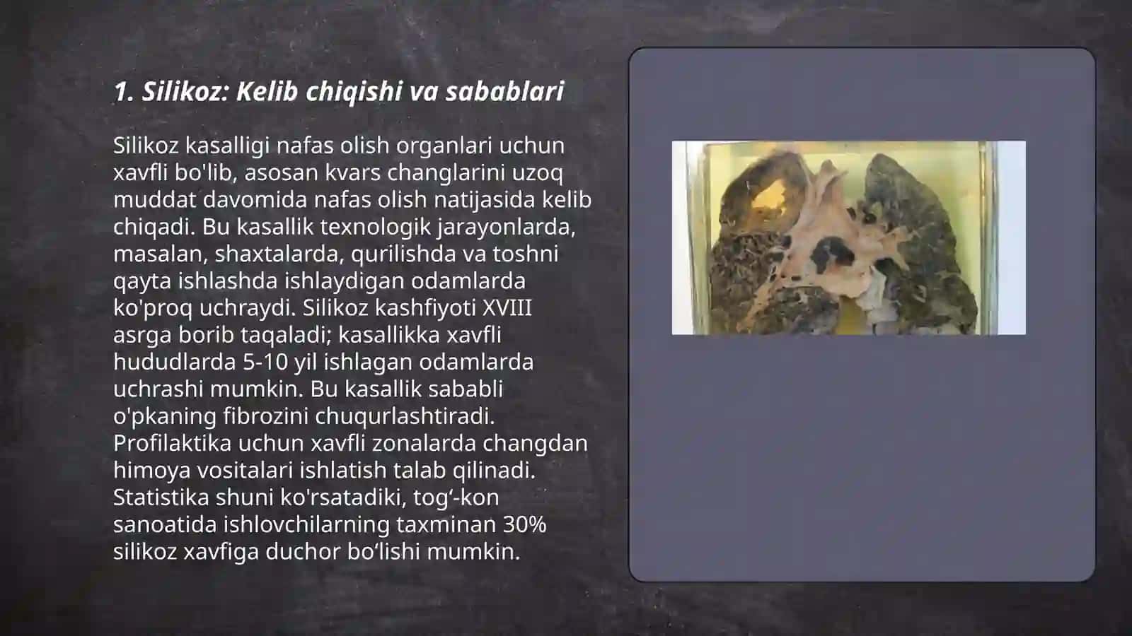 Silikoz klinikasi, diagnostikasi, davolash 3