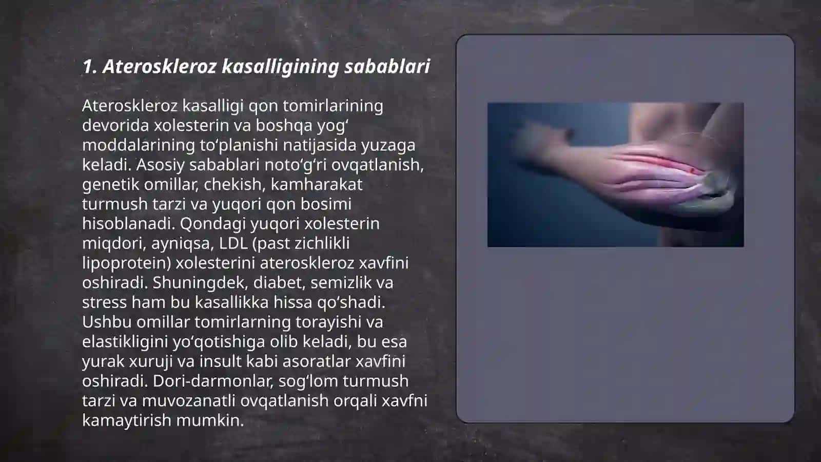 Ateroskleroz kasalligi haqida 3