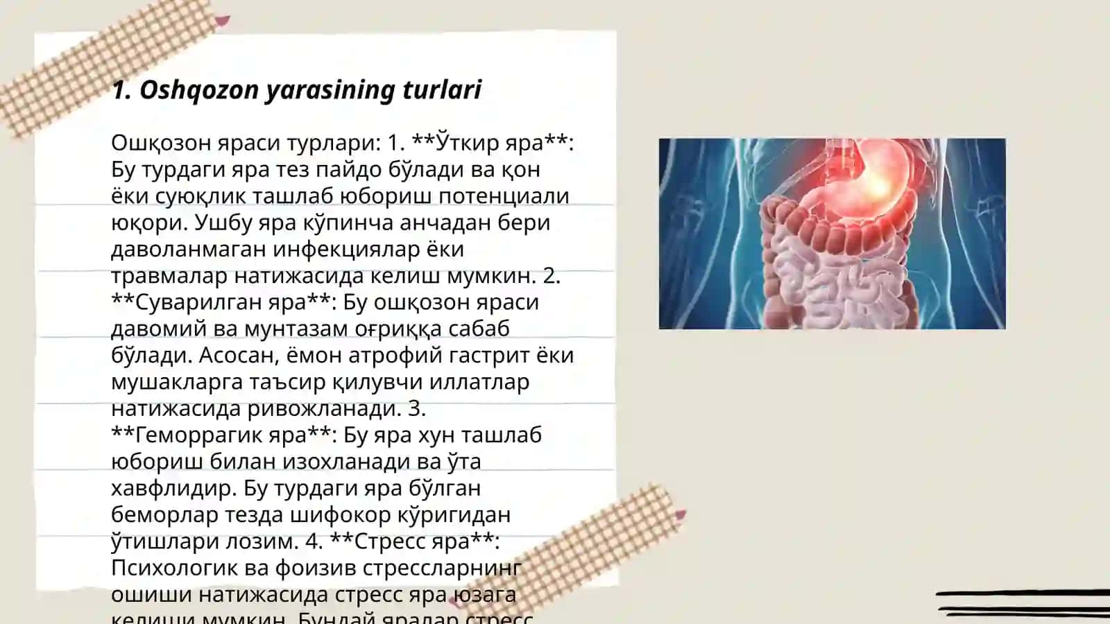 Oshqozon yarasi 3