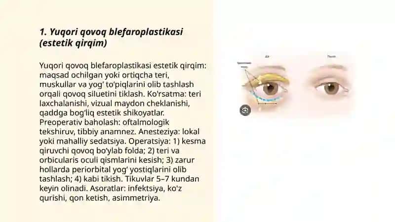 Yuqori qovoq blefaroplastikasi (estetik qirqim) 3