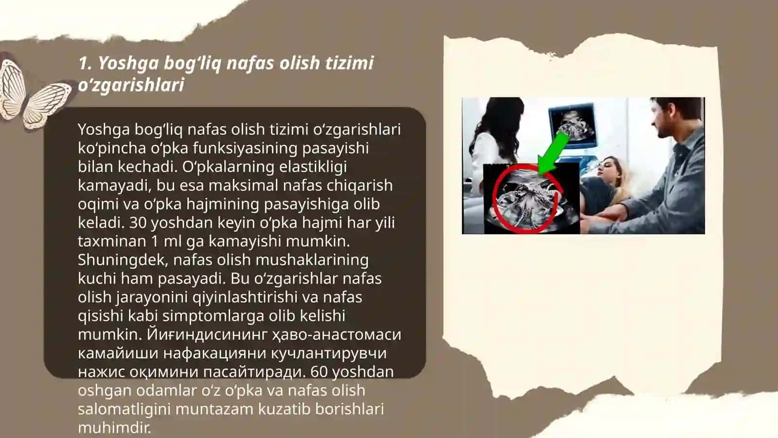 Yoshga bog‘liq nafas olish tizimining yoshga og‘liq xususiyatlari va gigiyenasi Shodiyeva Lobar 3