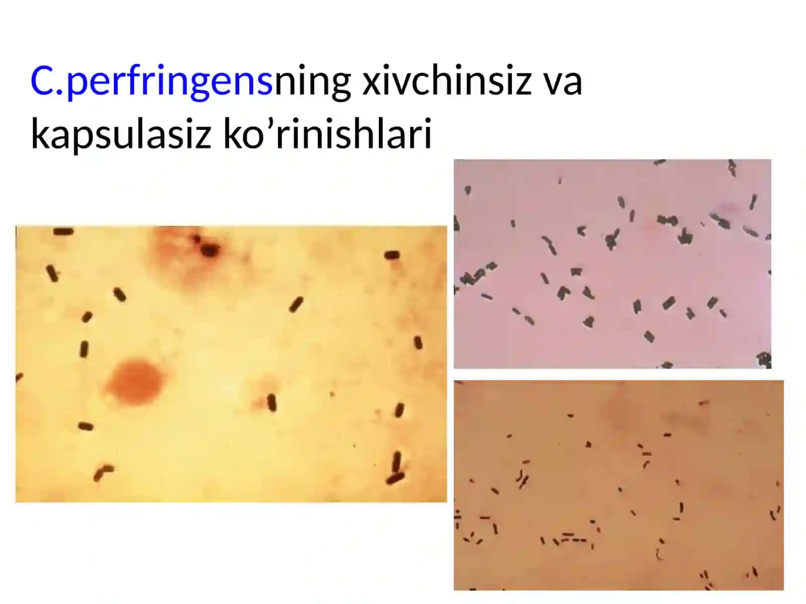 Gazligangrena qo’zg’atuvchilari 3