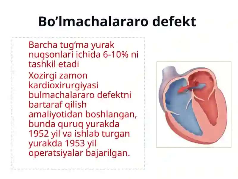 TUG‘MAYURAK NUQSONLARI 3
