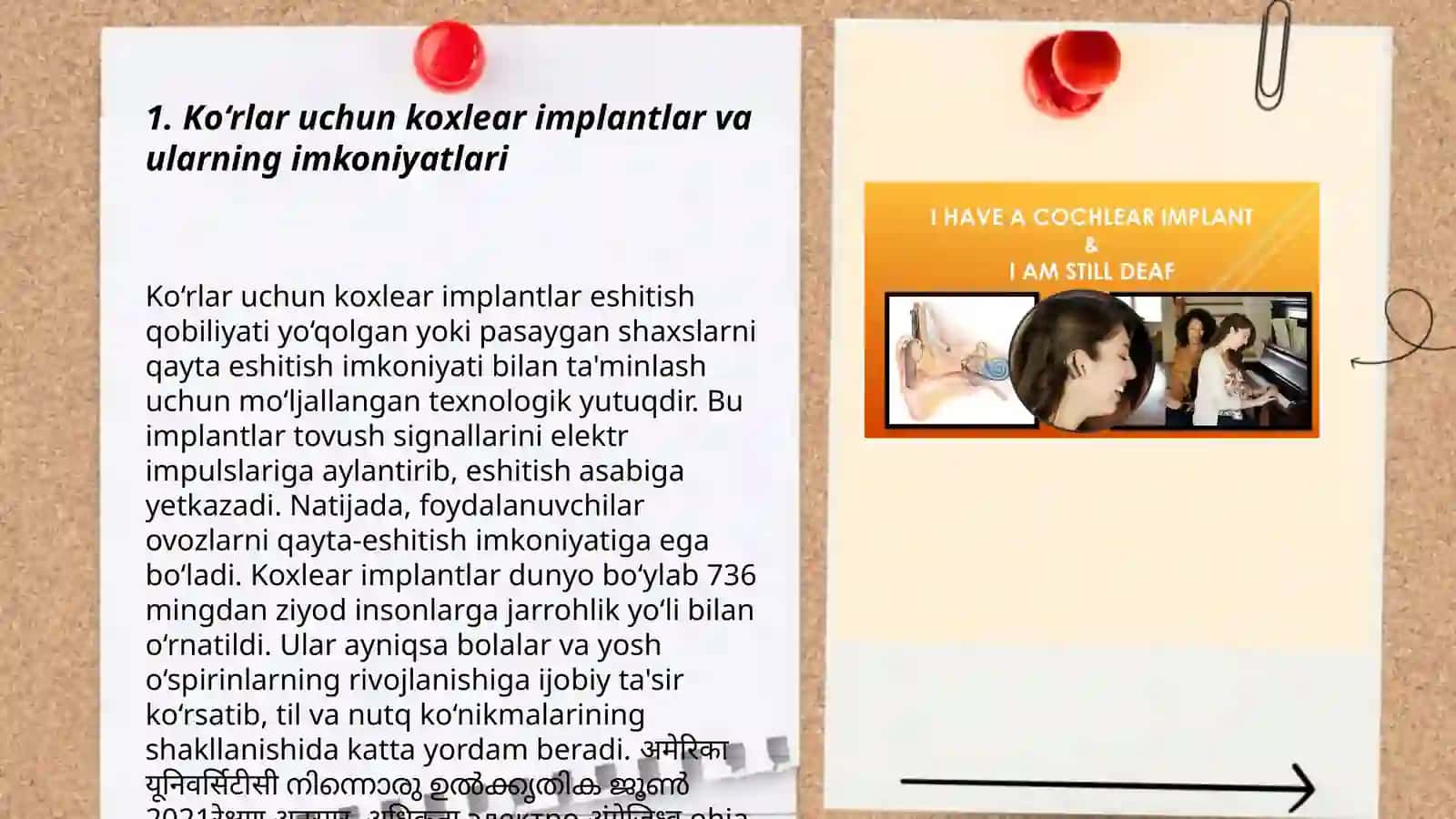 Koxlear implantli bolalar eshitish idrokini rivojlantirish metodlari 3