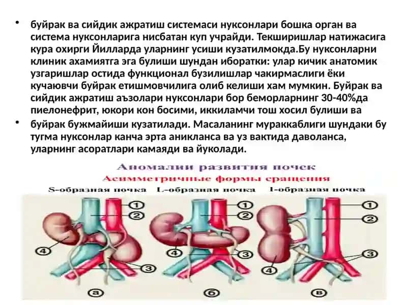 Болаларда буйрак, сийдик йуллари ривожланиш нуксонлари ва сийдик тош касаллиги диагностикаси ва даволаш тактикаси 3