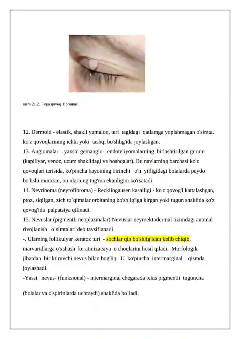 Ko'z qovoqlarining o'smalari 3