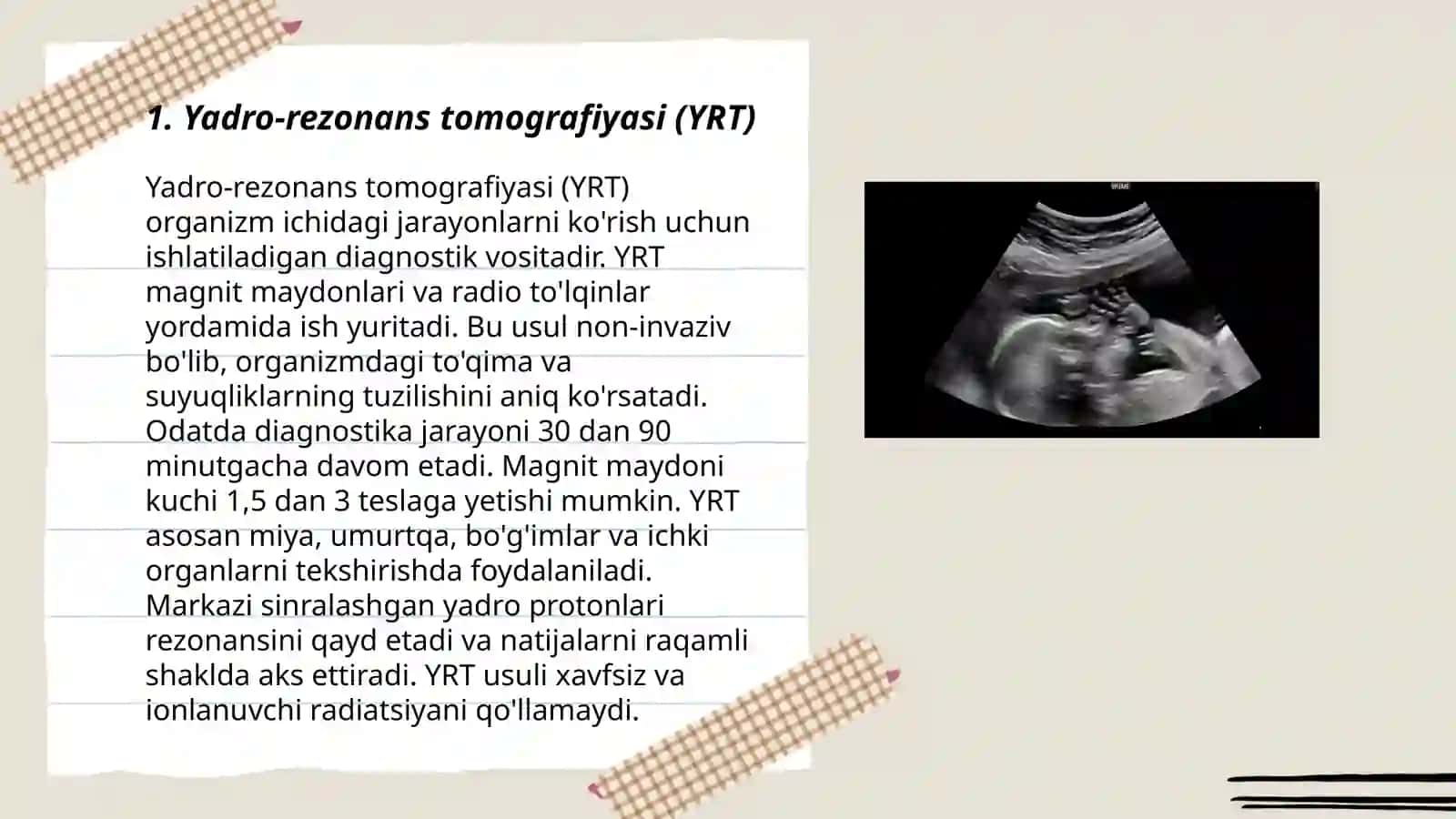 Tibbiyotda qo'llanadigan zamonaviy klinik usullari (UZl,dopplerografiya) 3