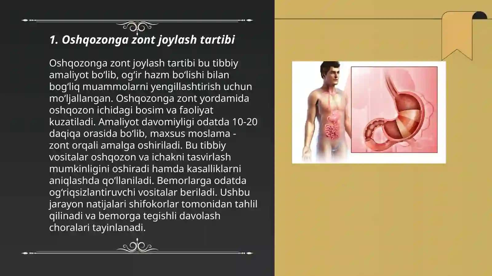 Oshqozonga zont qoyish 3