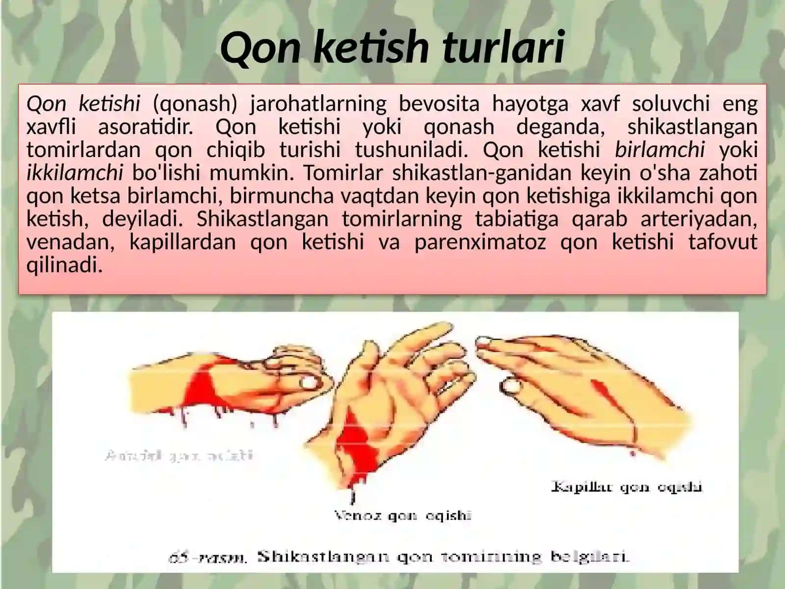 Qon ketish turlari 3
