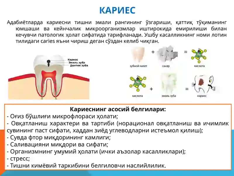 Оғизбўшлиғининг Профессионал гигиенаси. Кариес профилактикаси 3