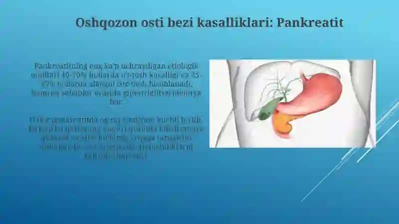 Oshqozon osti bezi kasalliklari: Pankreatit 3