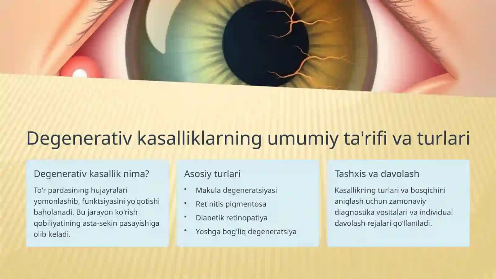 Ko'z to'r pardasining degenerativ kasalliklari 3