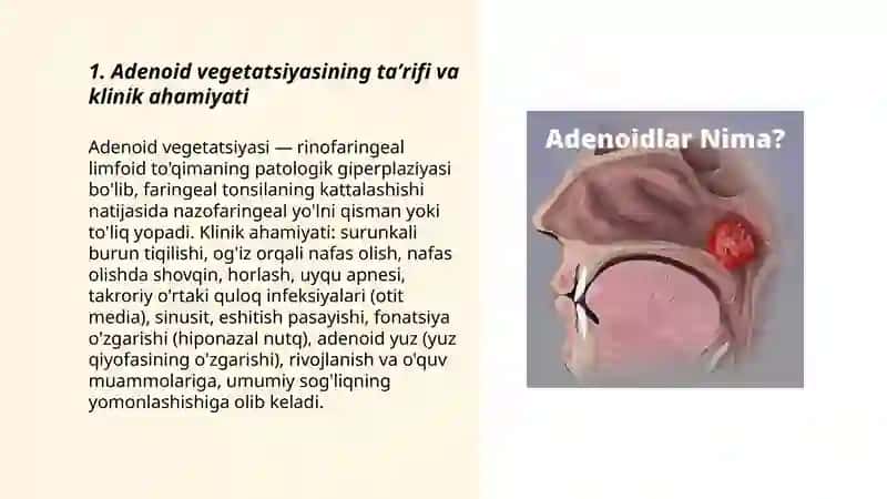 Adenoid vegetatsiyasi.Tashxislash usullari 3
