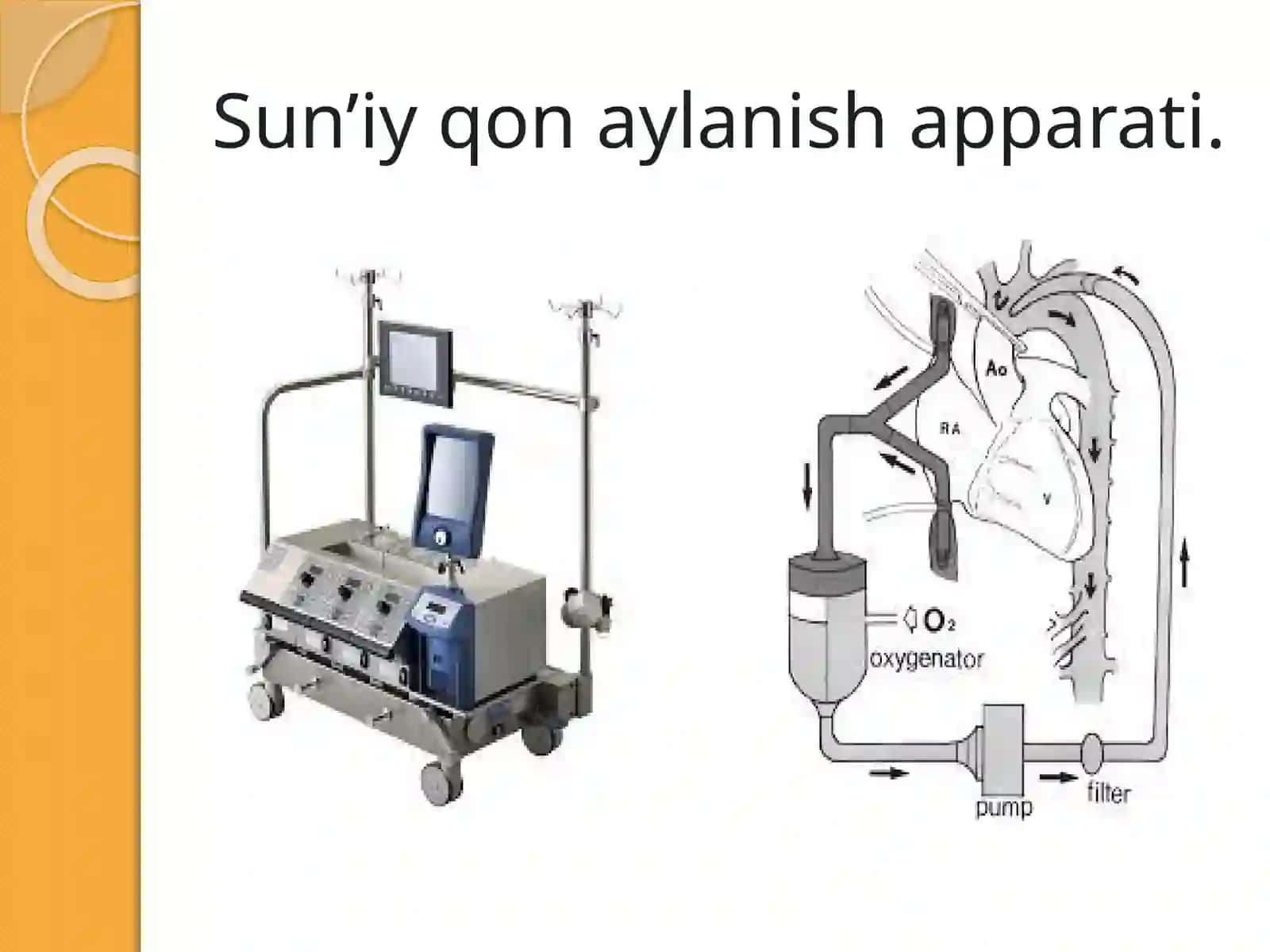 Sun’iy qon aylanish apparati 3
